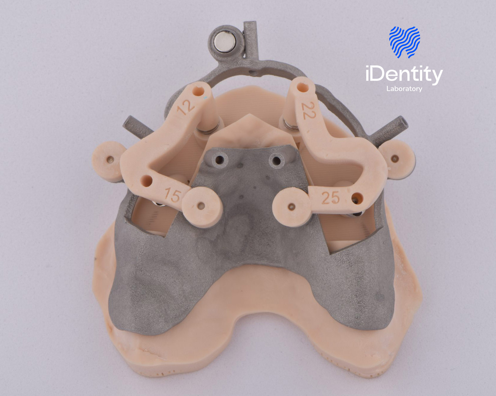 Close-up of a beige dental model with gray metal framework and numbered beige plastic components.