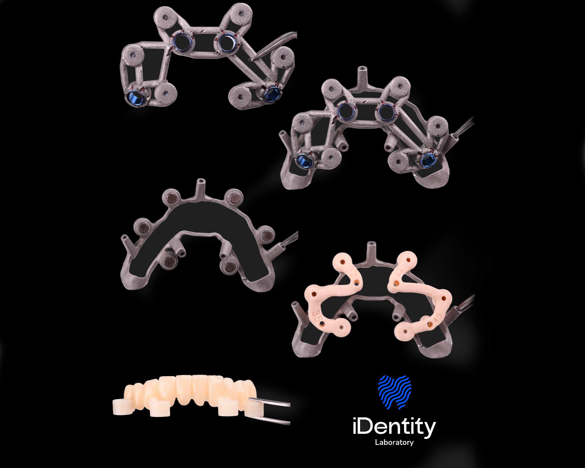 Five dental implant surgical guide components and a dental prosthetic set against a black background with iDentity Laboratory logo.