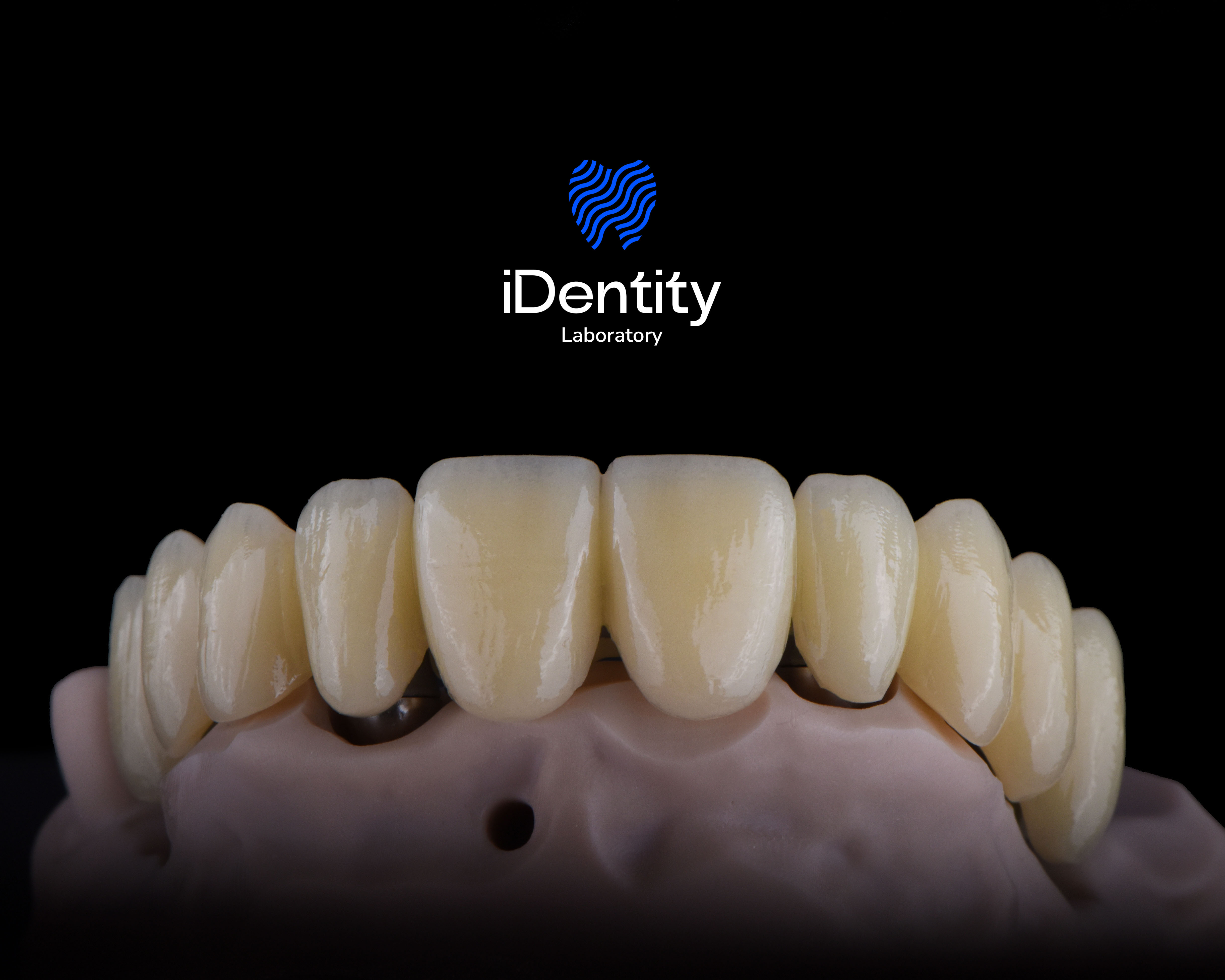 Close-up of a dental model featuring a set of artificial upper front teeth against a black background with the iDentity Laboratory logo above.