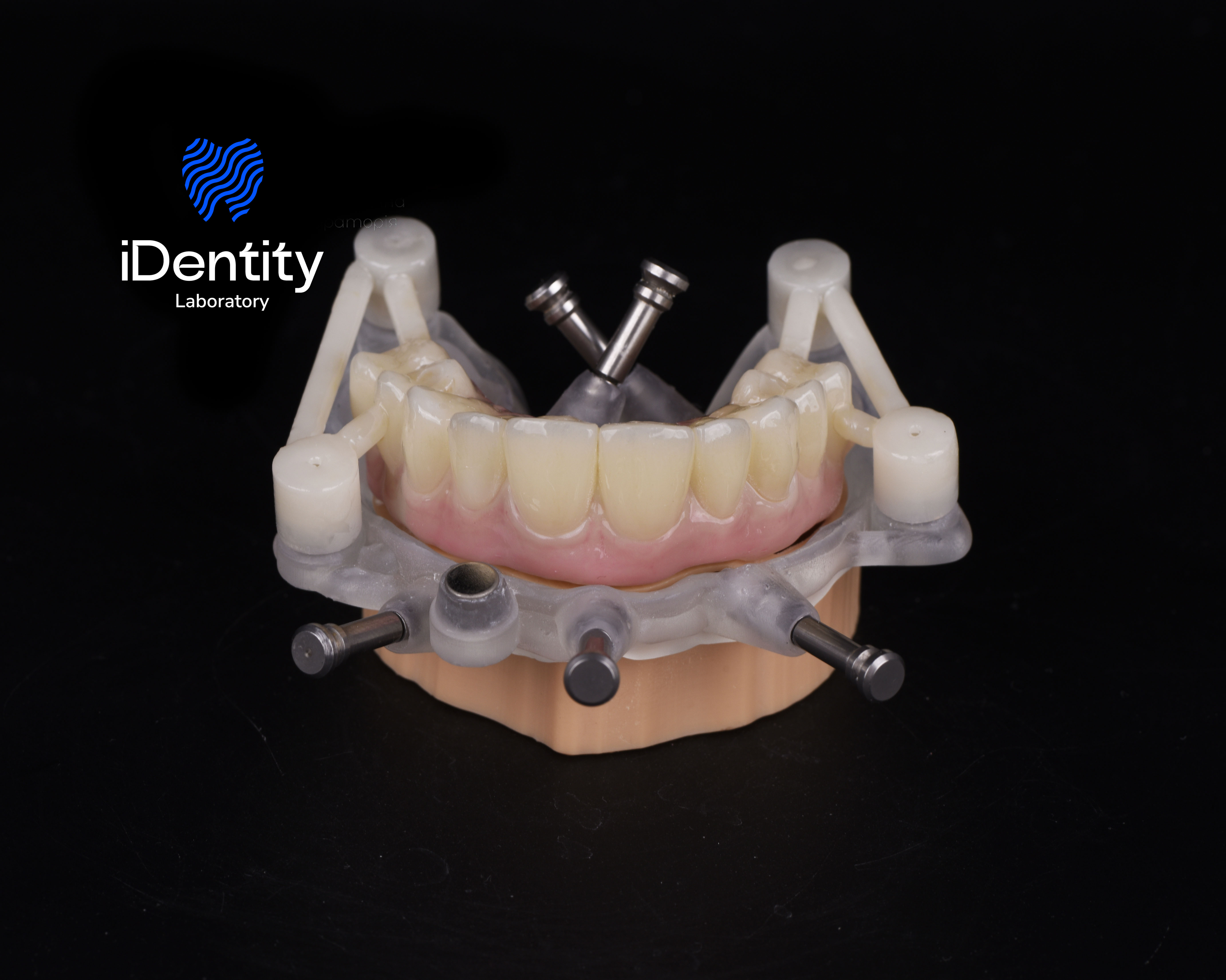 Dental model showing a lower denture with artificial teeth attached to a surgical guide with metal pins on a black background.