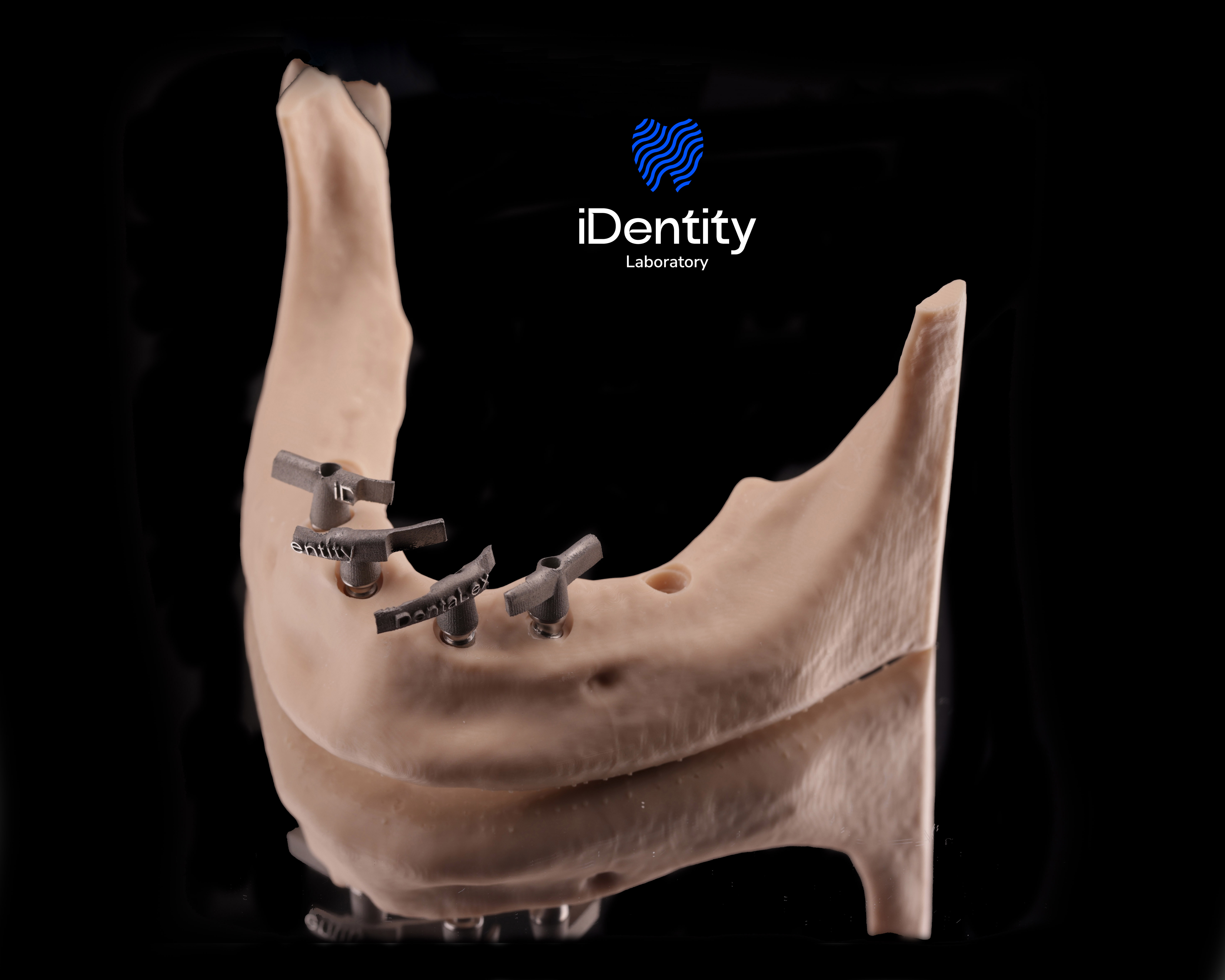 Dental model of a lower jaw with three dental implant analogs attached, displayed on a reflective black surface with iDentity Laboratory logo above.