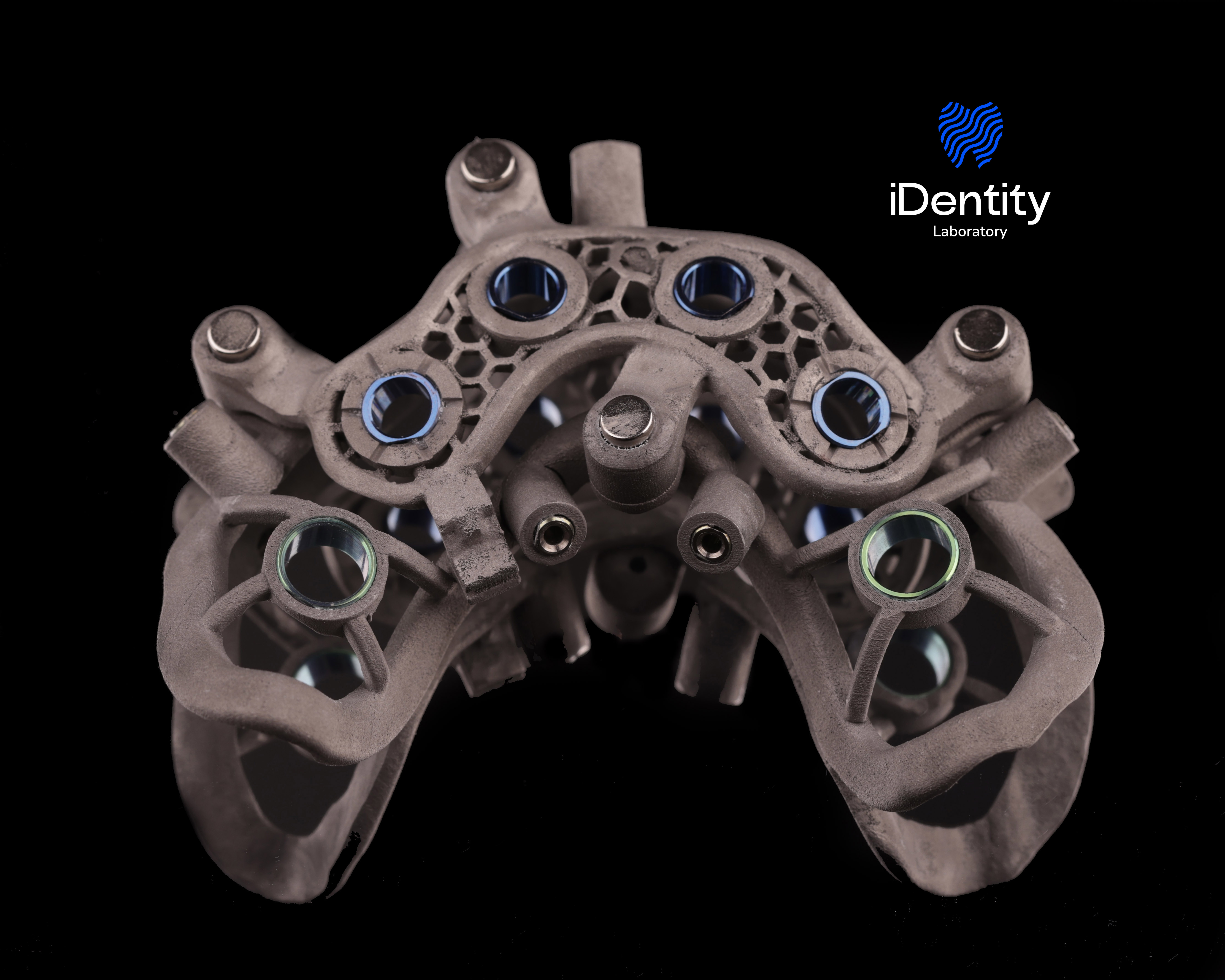 3D-printed dental model with metallic rings against black background, featuring iDentity Laboratory logo.