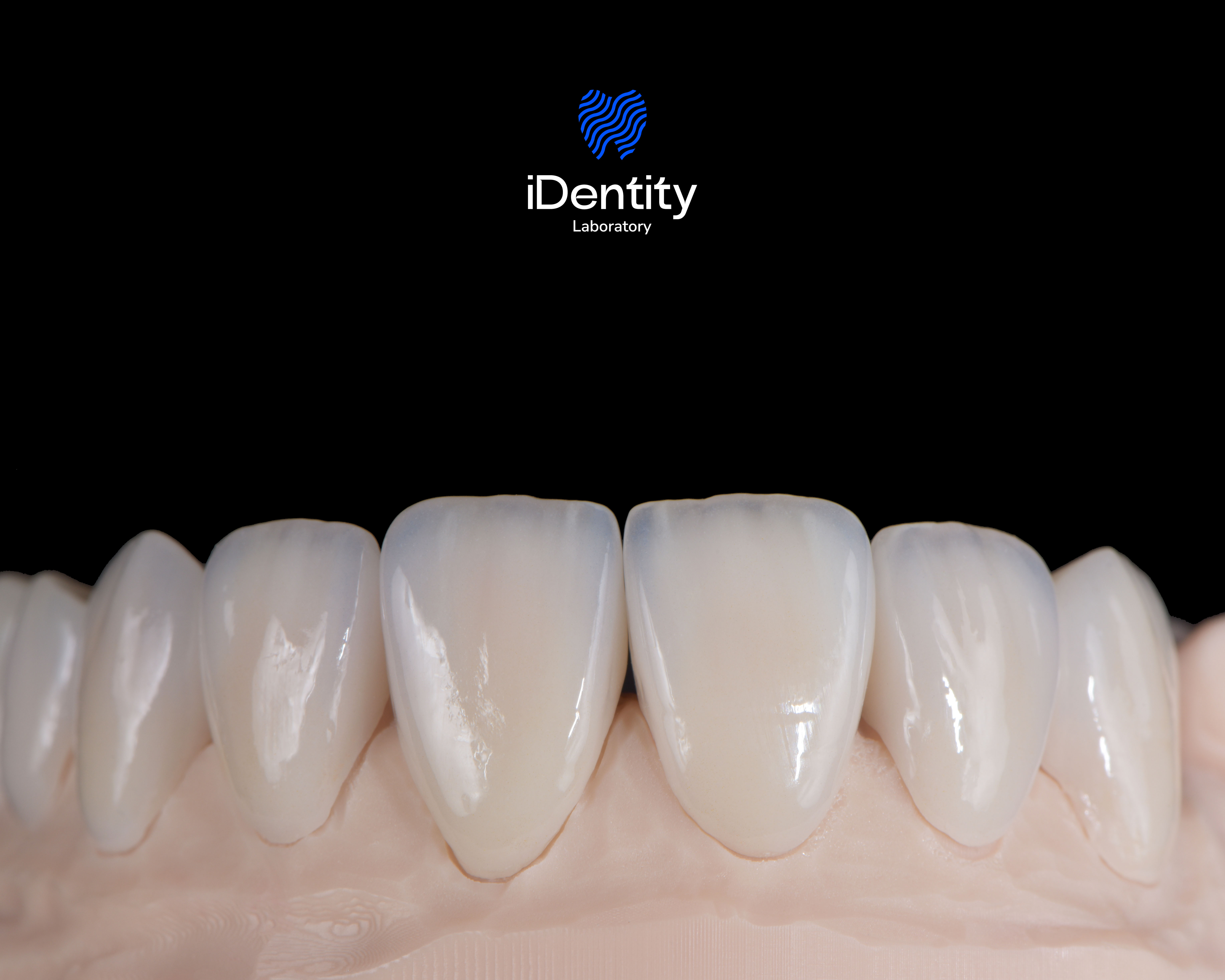 Close-up of six realistic upper front dental veneers on a pink gum model with a black background and iDentity Laboratory logo above.