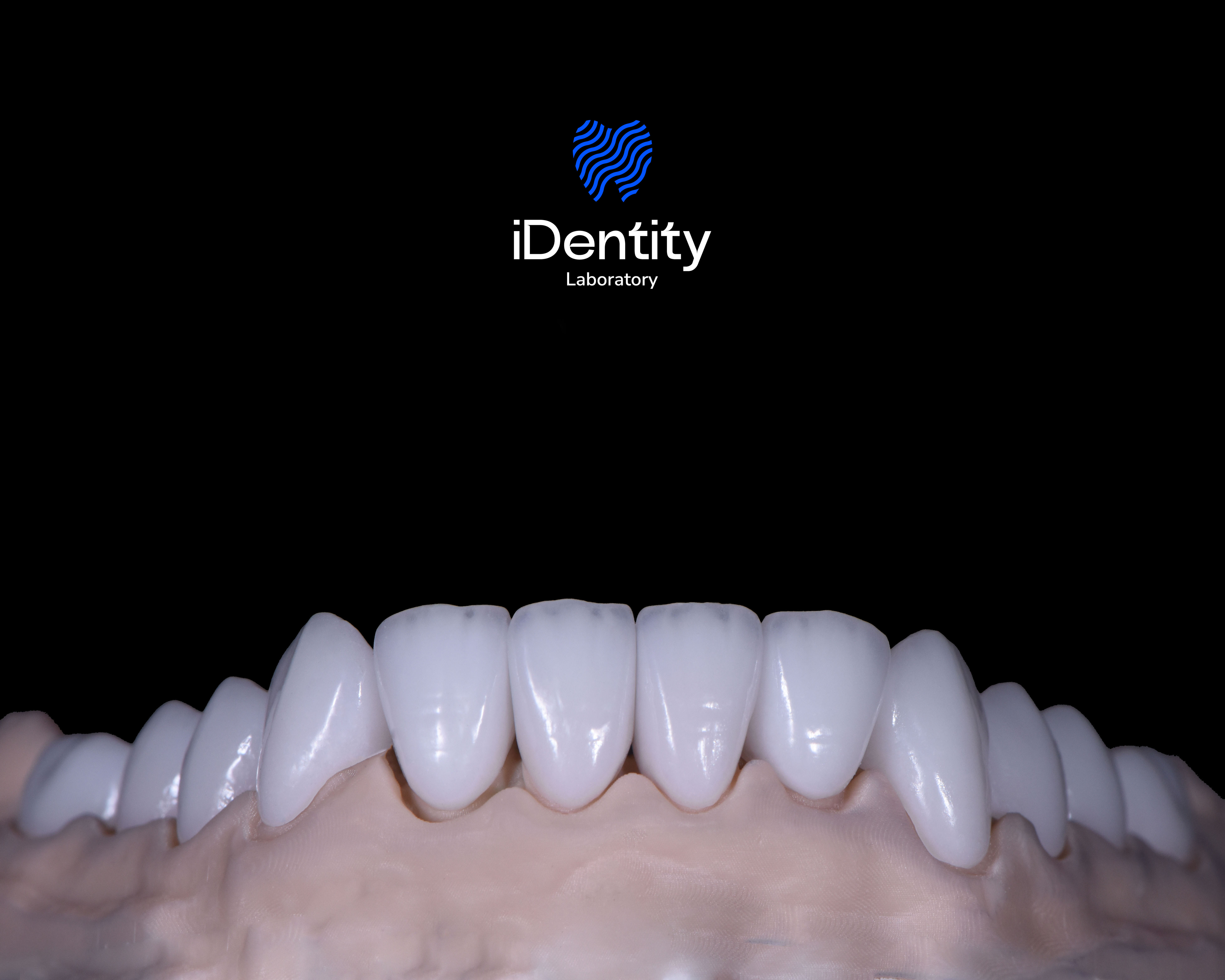 Close-up of a dental model showing a full set of white upper front teeth against a black background with the Identity Laboratory logo above.