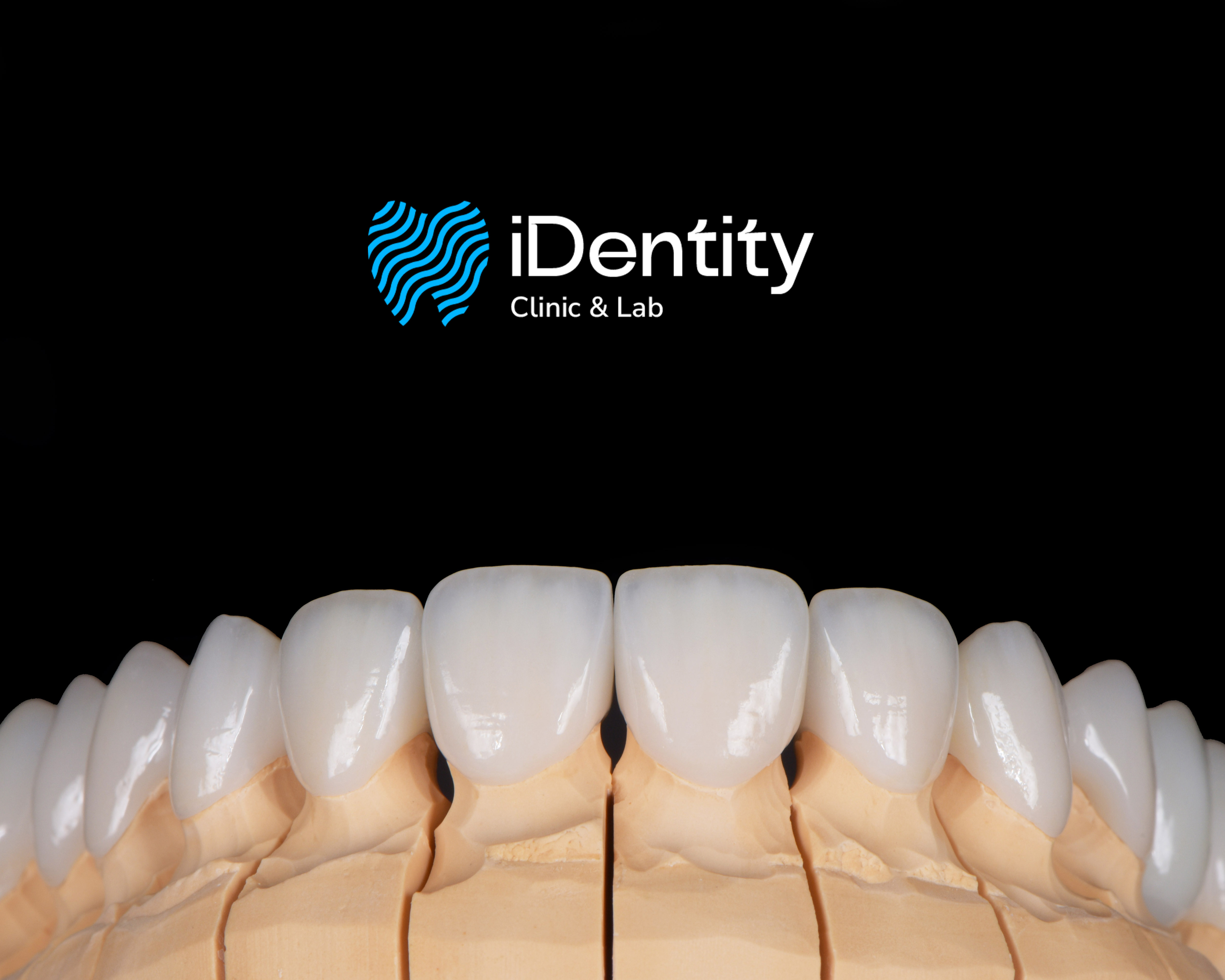 Dental model showing a close-up of upper front teeth crowns with iDentity Clinic & Lab logo above on a black background.