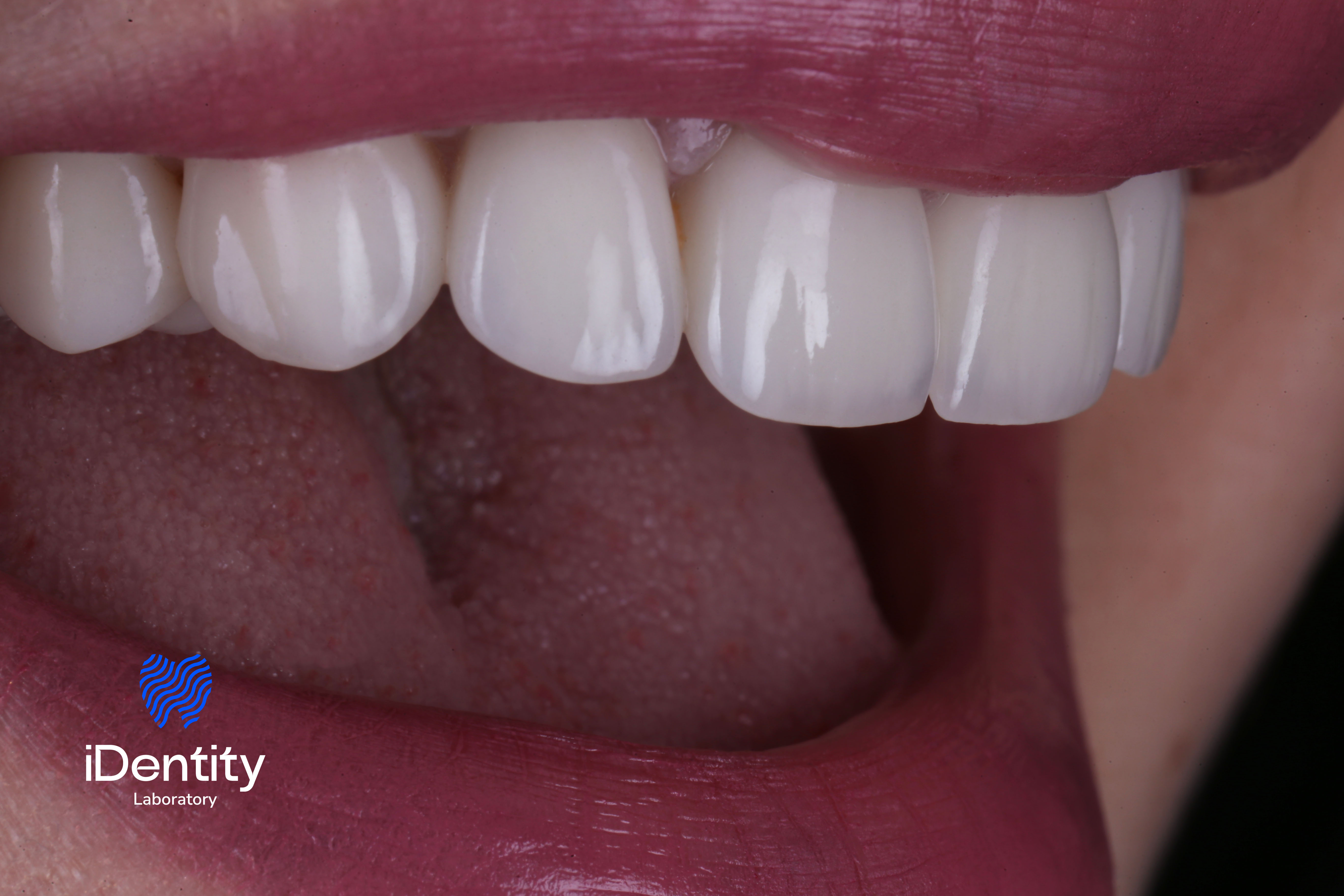 Close-up of a smiling mouth showing clean, white teeth and pink lips.