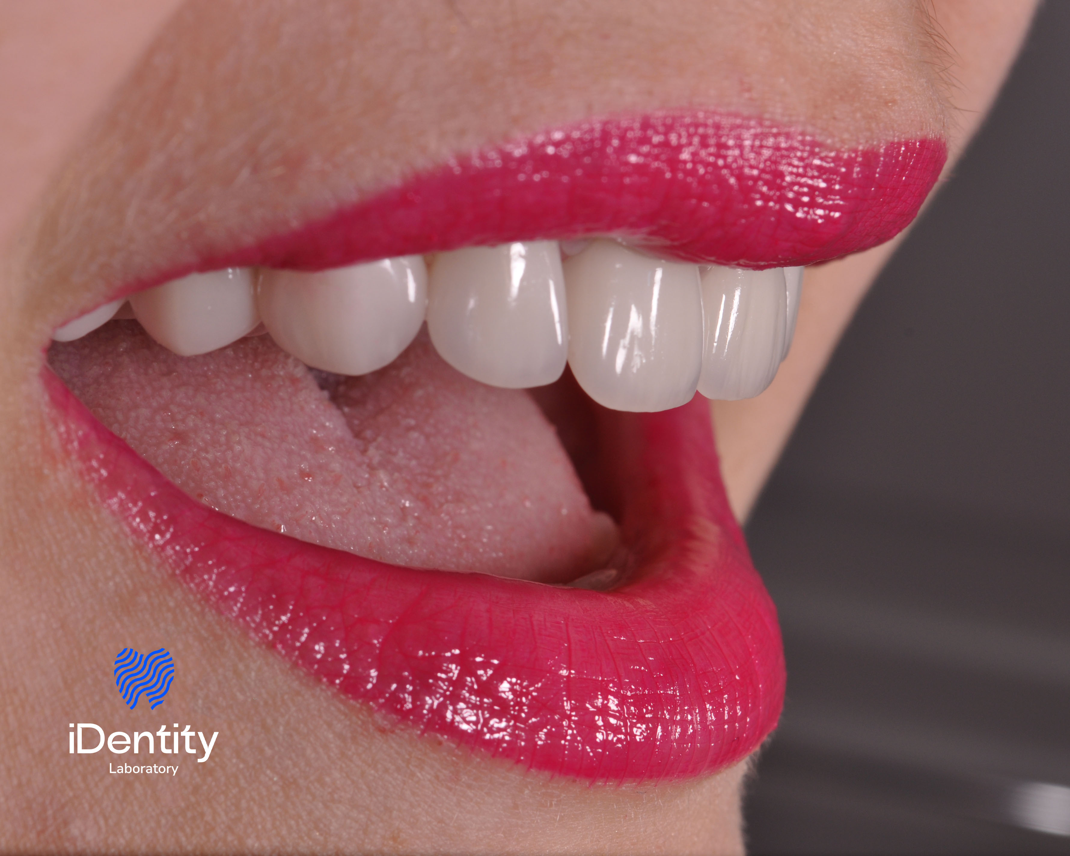 Close-up of a smiling mouth with white teeth and bright pink lipstick.