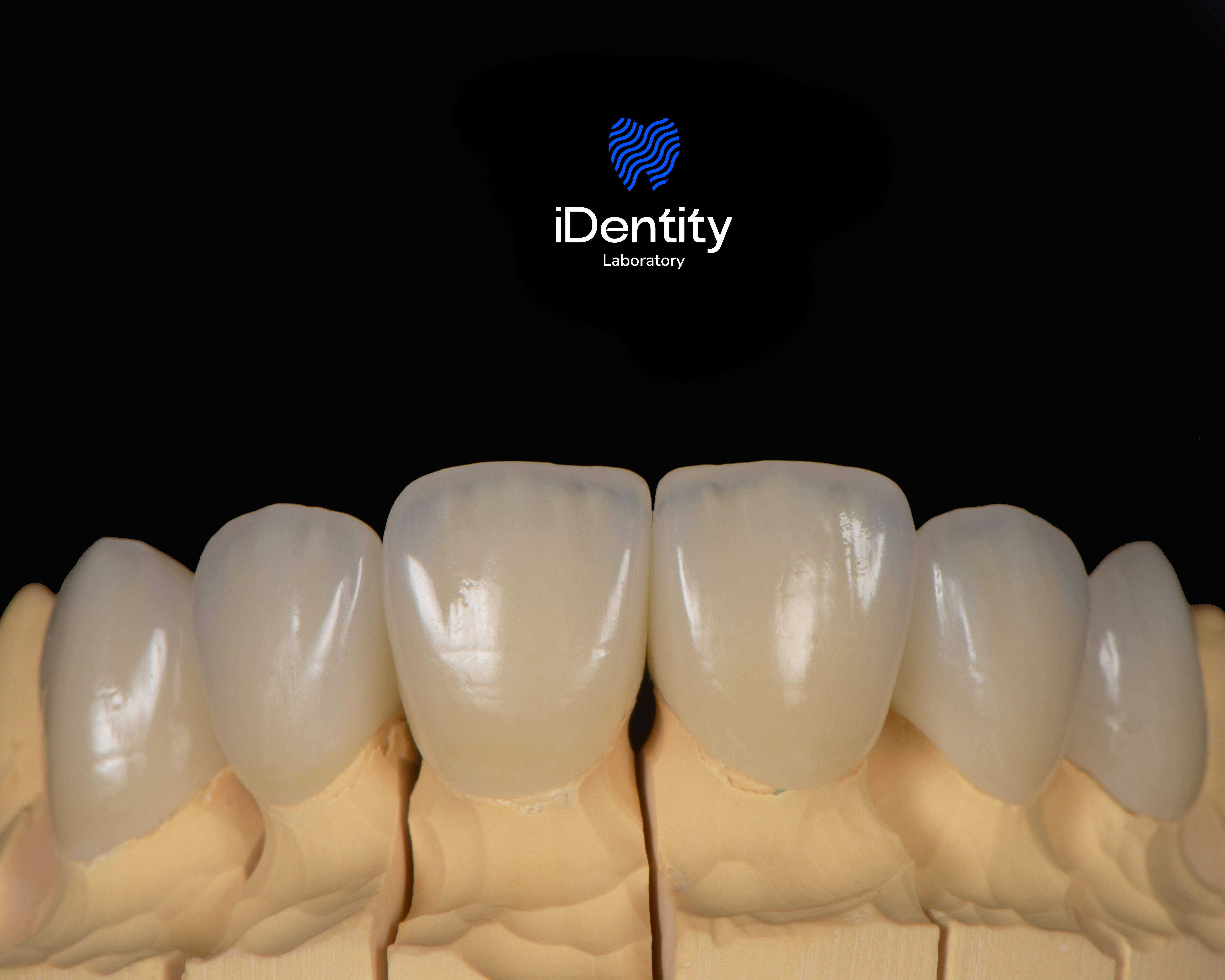 Close-up of six dental crowns on a beige model base against a black background with the iDentity Laboratory logo above.