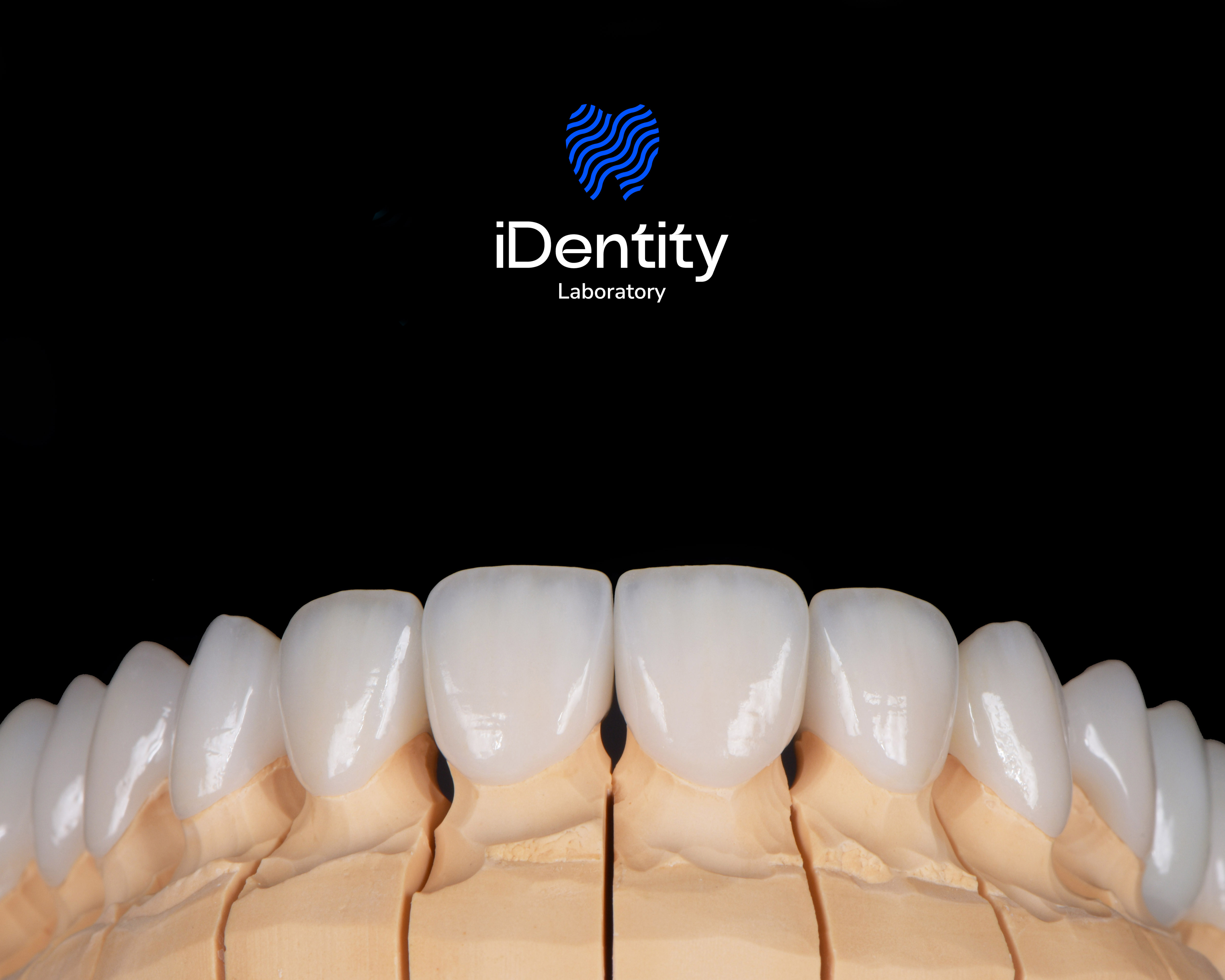 Dental model showing upper front teeth crowns with iDentity Laboratory logo above on black background.
