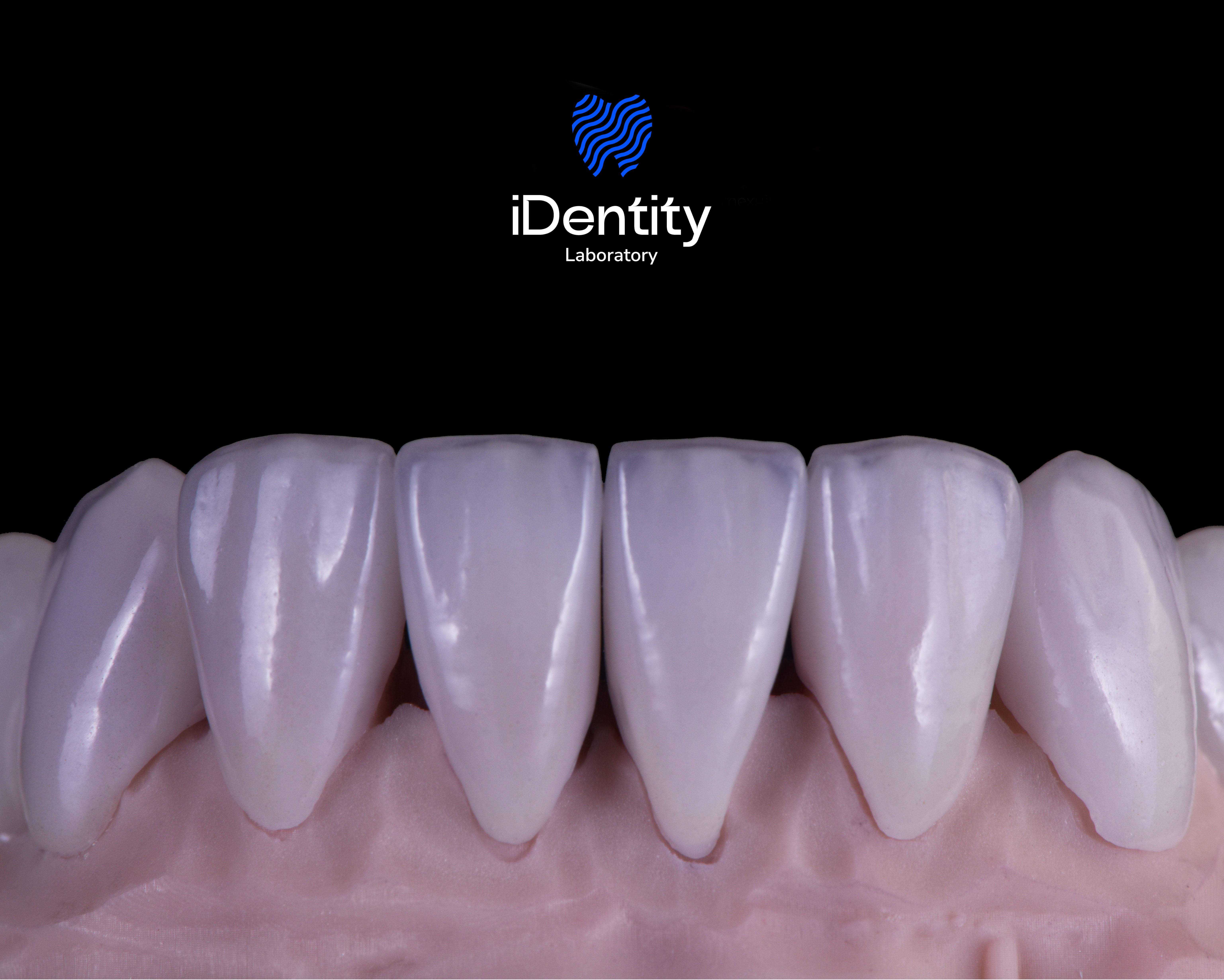 Close-up of six upper front dental veneers mounted on a pink gum model against a black background with an iDentity Laboratory logo above.