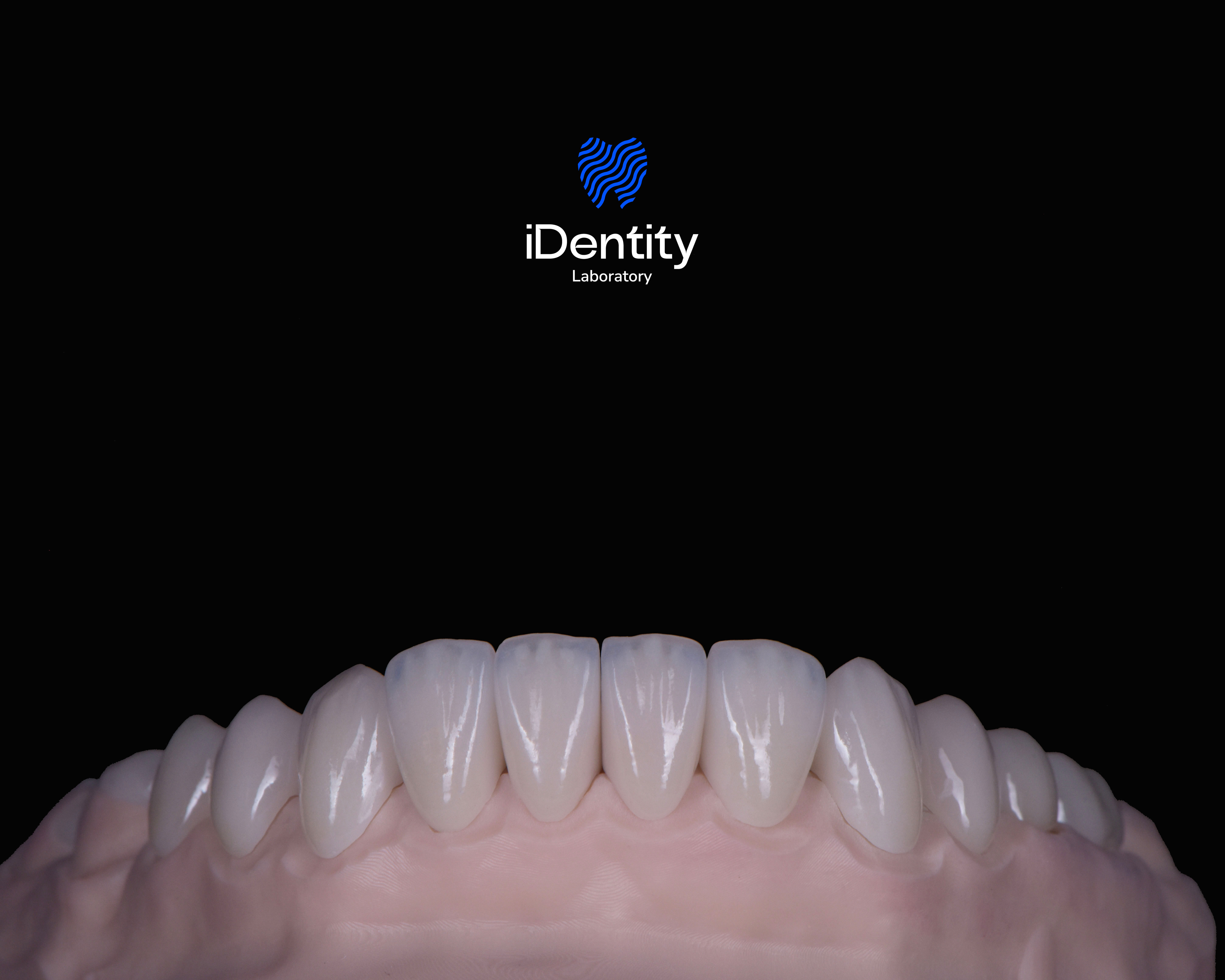 Close-up of upper dental model with white teeth on a black background and iDentity Laboratory logo above.