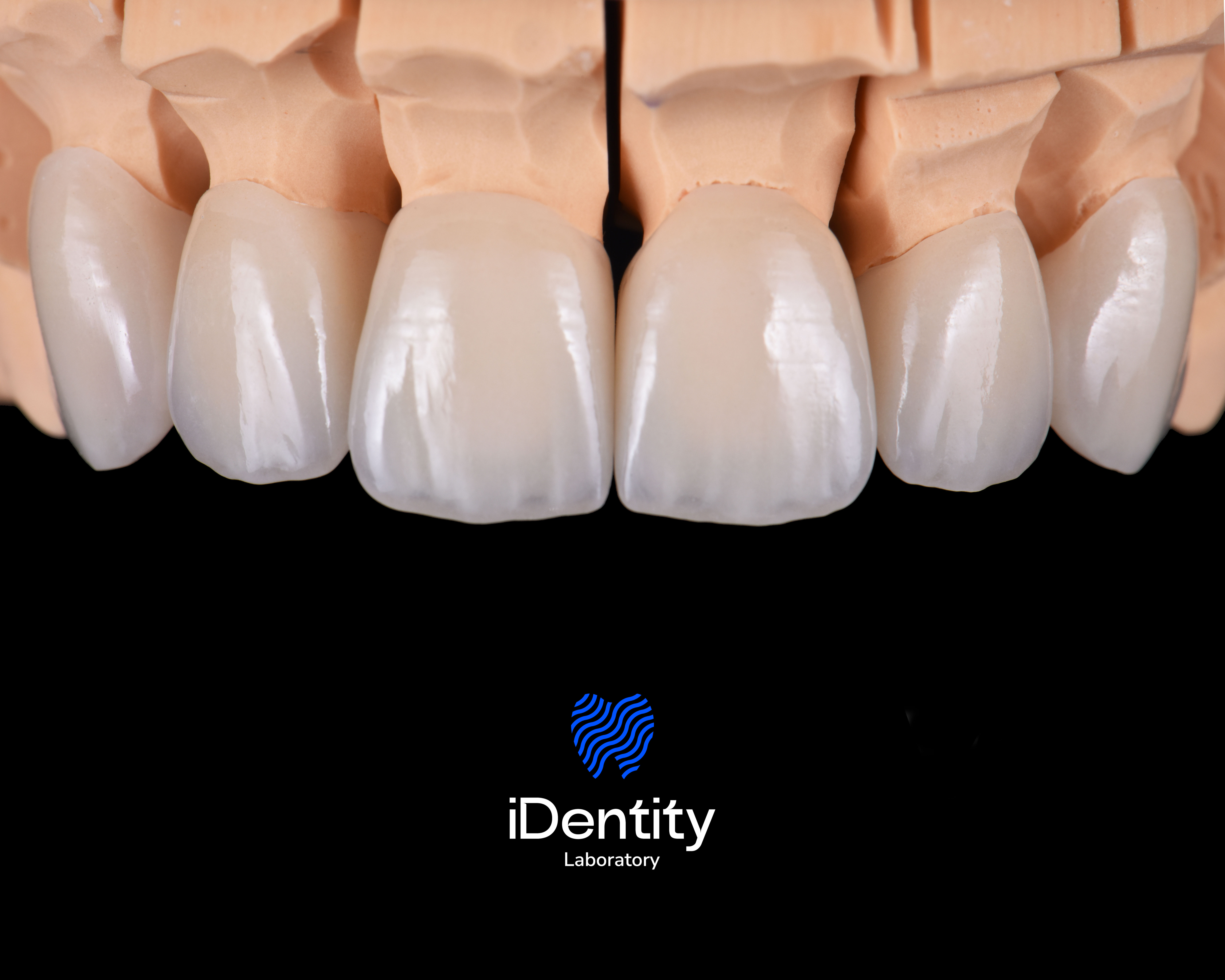 Close-up of dental prosthetic teeth on a beige mold with a black background and iDentity Laboratory logo below.