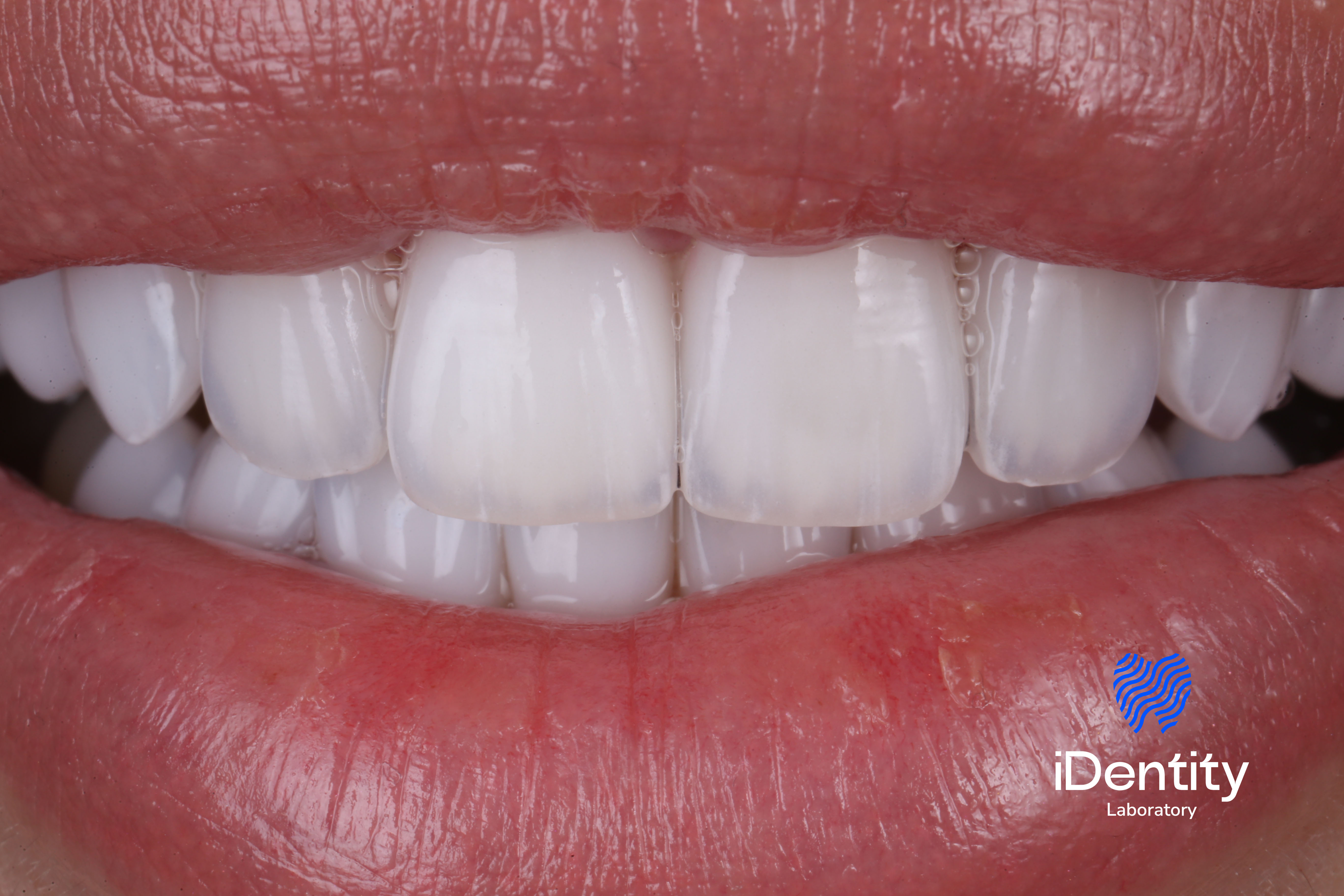 Close-up of a smiling mouth showing clean, white teeth and natural lips.