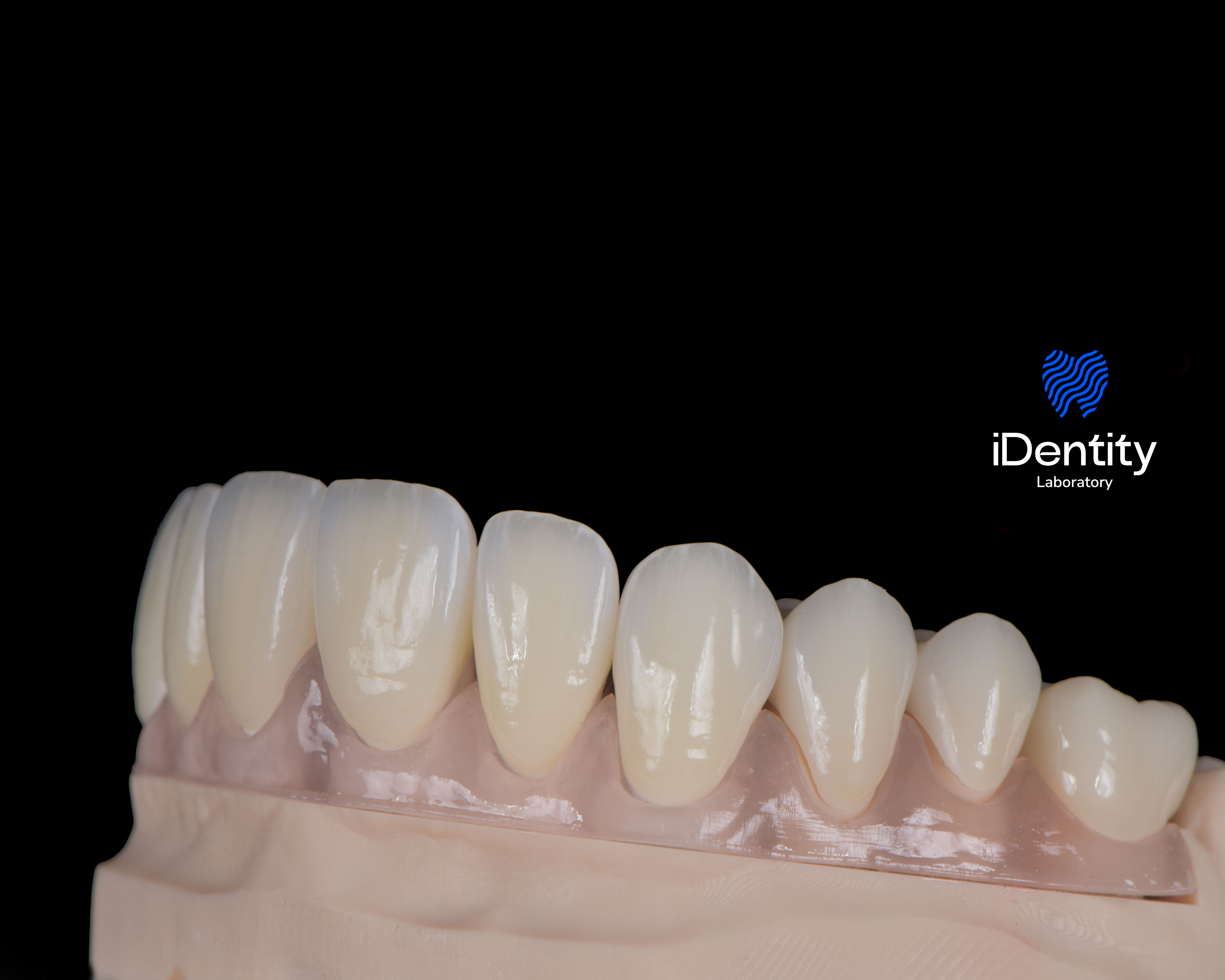 Close-up of artificial dental teeth on a gum model against a black background.