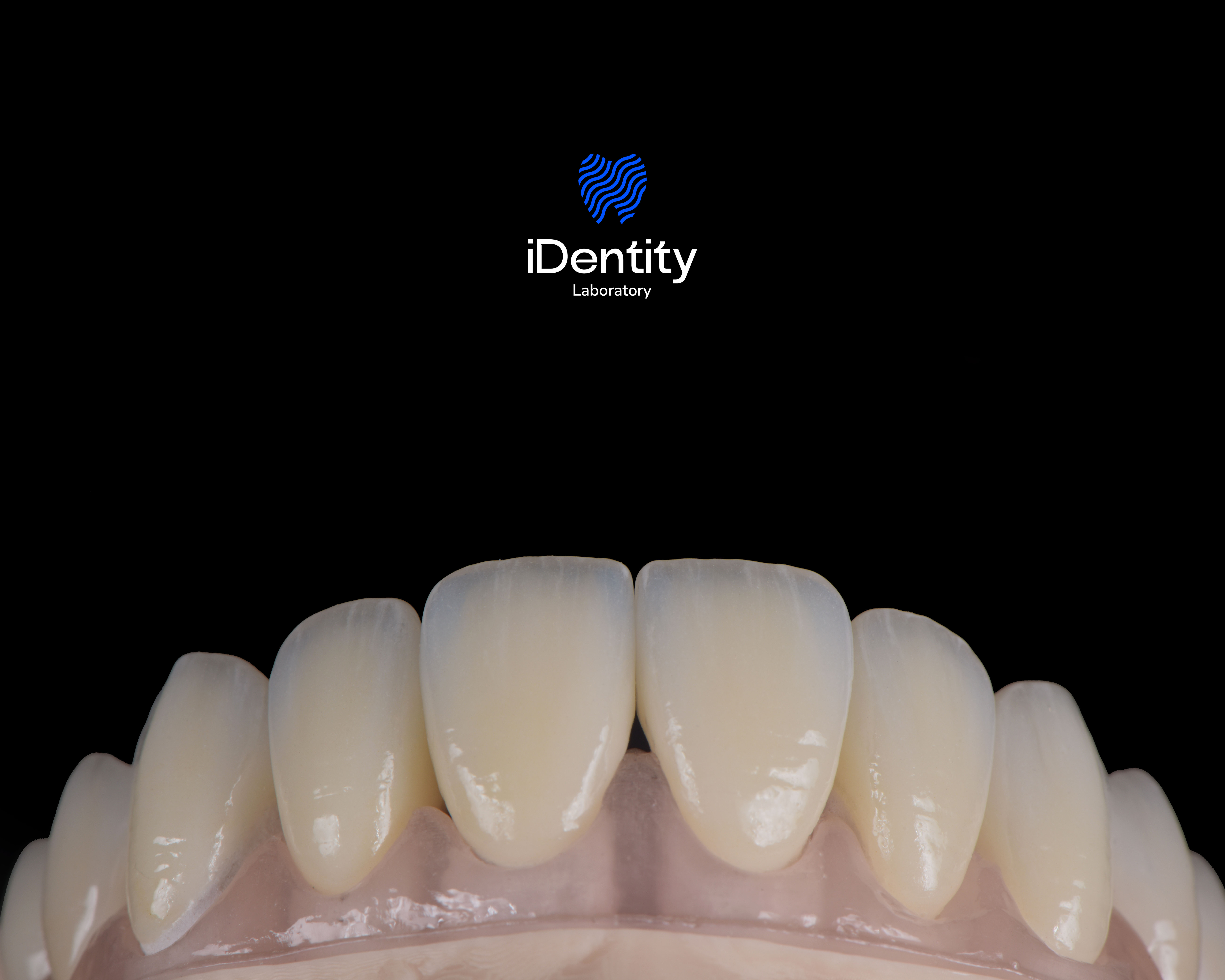 Close-up of upper front teeth and gums against a black background with the iDentity Laboratory logo above.