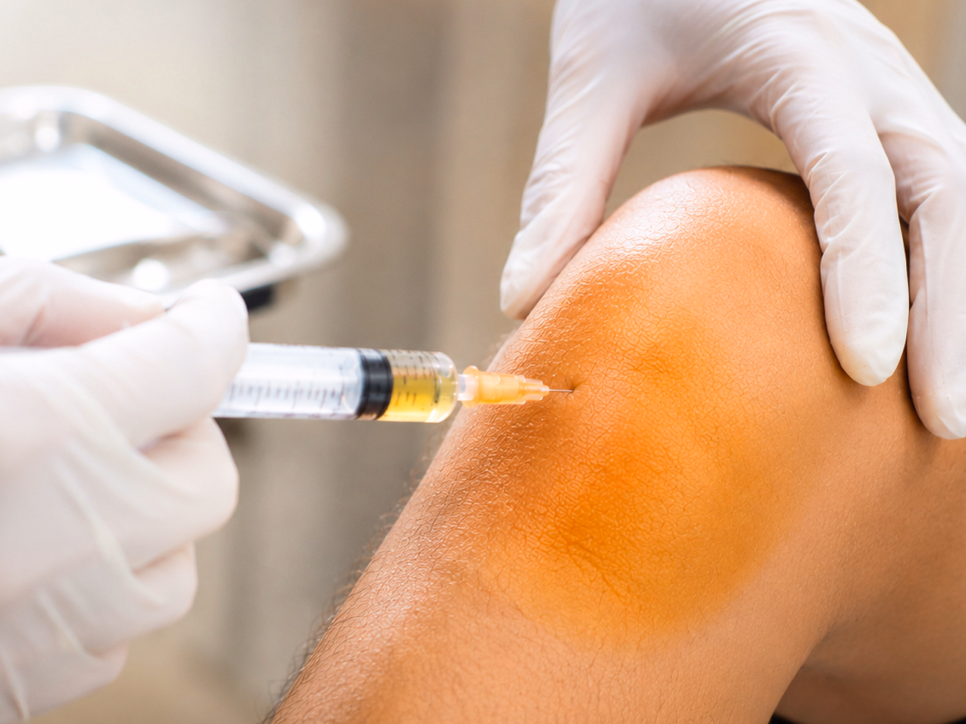 Physician performing a precision local stem cell injection for knee joint treatment under sterile medical conditions.