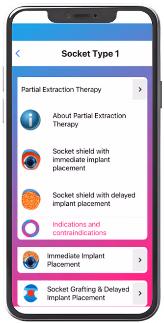 Smartphone screen showing a dental app menu with options for Partial Extraction Therapy, Immediate Implant Placement, and Socket Grafting & Delayed Implant Placement.