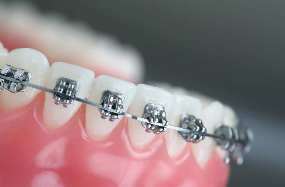 Ортодонтія