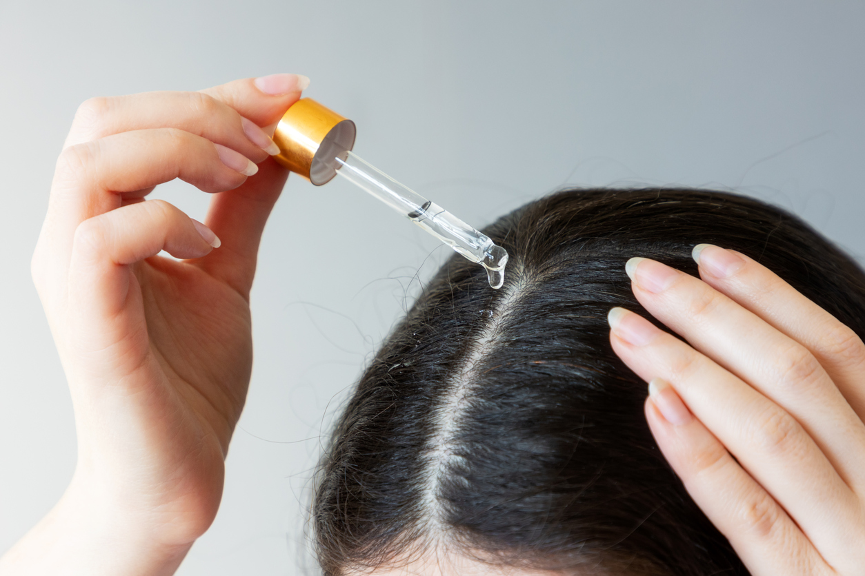Woman applying topical hair loss solution to her scalp as part of a female pattern hair loss treatment routine.
