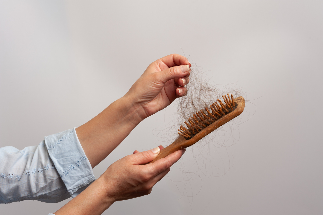 Hairbrush filled with shed hair, illustrating excessive hair loss and early hair thinning.