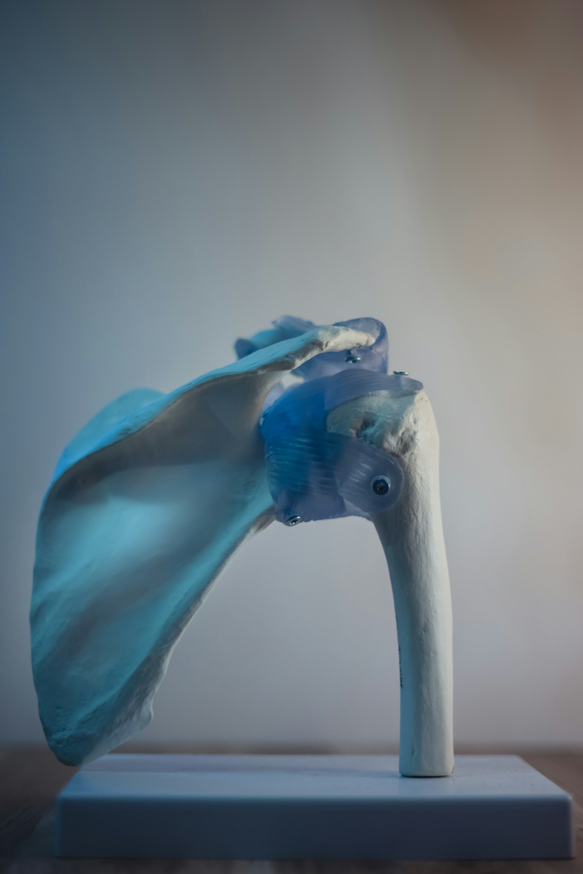shoulder replacement — Overview of the Procedure