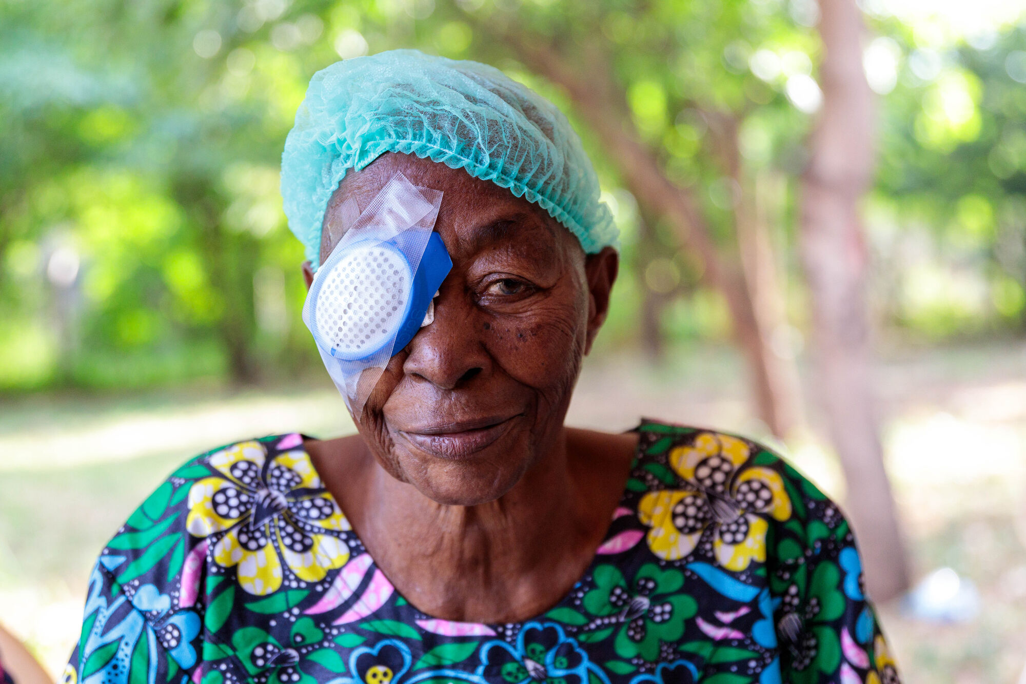 A woman recovering after cataract surgery