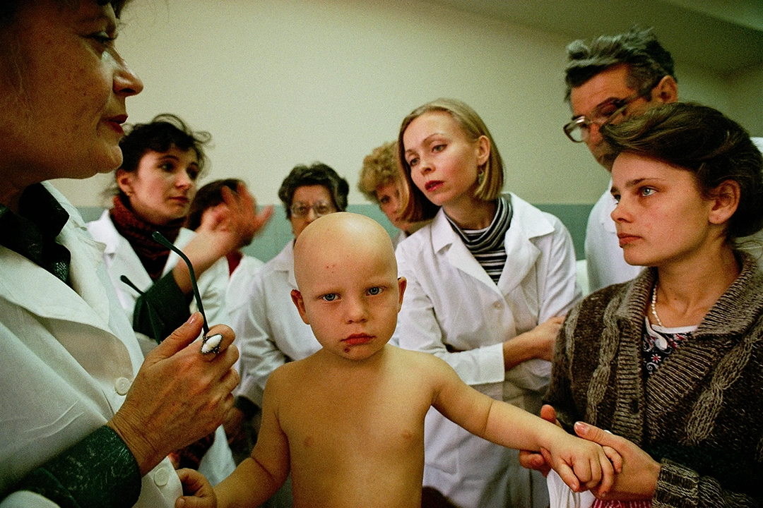 Doctors examine a child with alopecia in Kyiv. Cases of child baldness increased after the disaster. © Gerd Ludwig, 1993
