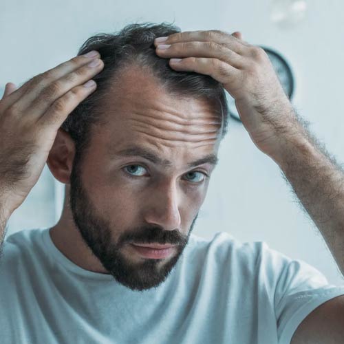 Man examining his hairline in the mirror, checking for oily scalp and dry ends