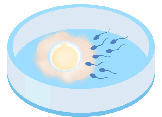 体外受精のイメージ