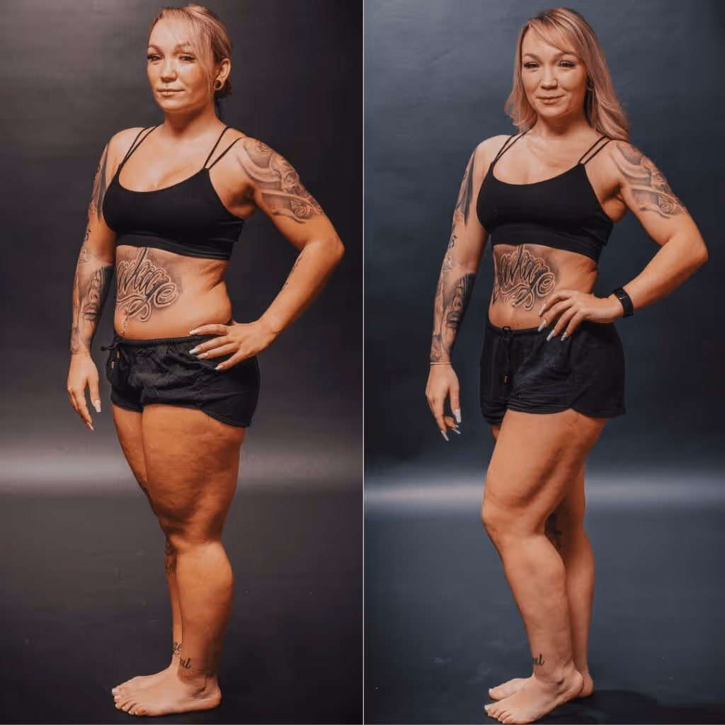 Teilnehmerin Mandy mit Lipödem Beinen Vorher Nachher. Sie hat 8 Kilo in 8 Wochen verloren