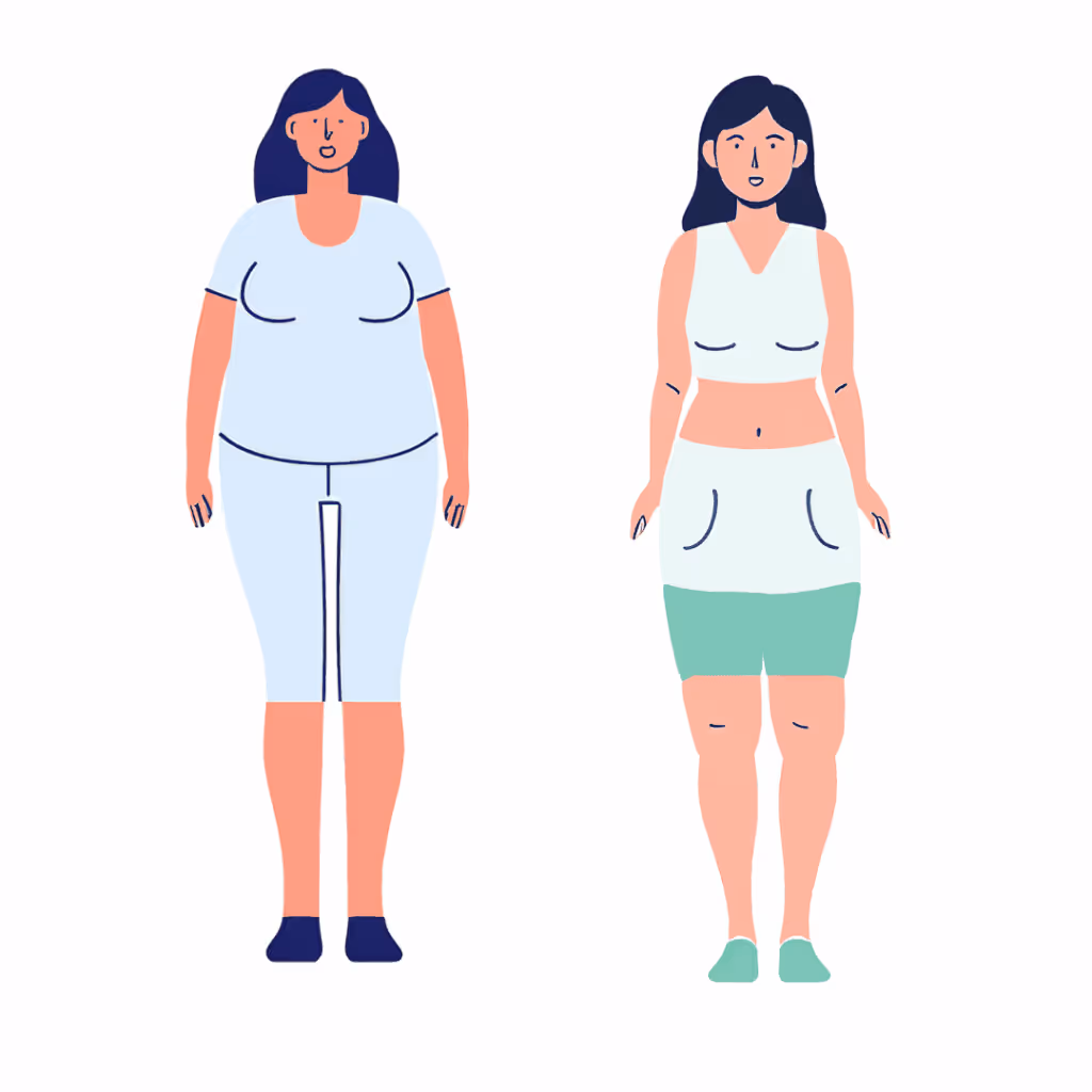 Illustration von zwei Frauen: Die rechte Frau zeigt das Lipödem im Stadium 2 mit Übergewicht, erkennbar an den ungleichmäßig verbreiterten Oberschenkeln und Waden, während die linke Frau eine normale übergewichtige Figur darstellt. Die Grafik verdeutlicht den Unterschied in der Körperform