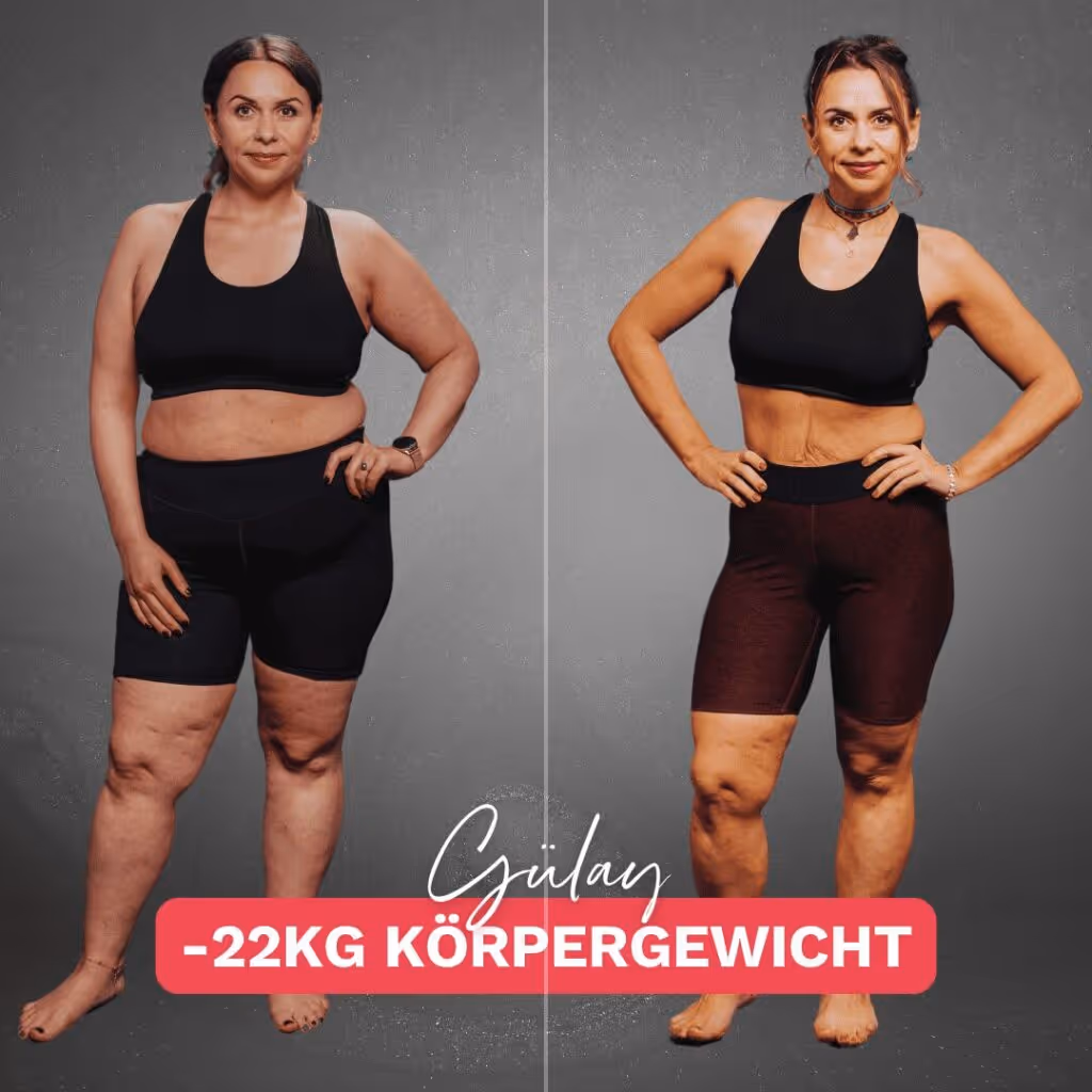 Teilnehmerin Gülay mit Lipödem Stadium 3 Beinen Vorher Nachher. Sie hat 22 Kilo in 5 Monaten verloren.
