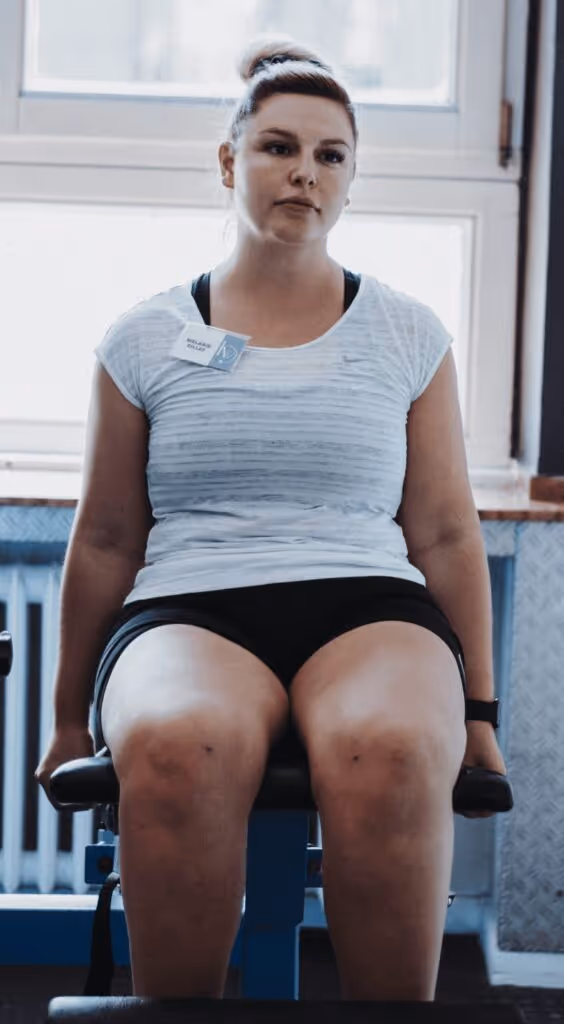 Frau mit Lipödem vor ihrer Körperverwandlung mit sichtbaren OP-Narben nach Fettabsaugung – Beispiel für operative Lipödem-Behandlung.