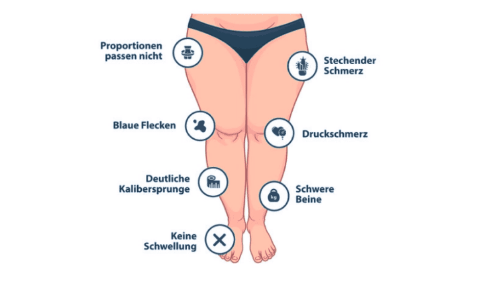 Typische Beschwerden beim Lipödem – eine Übersicht der häufigsten Symptome, die durch Ernährung Lipödem positiv beeinflusst werden können.