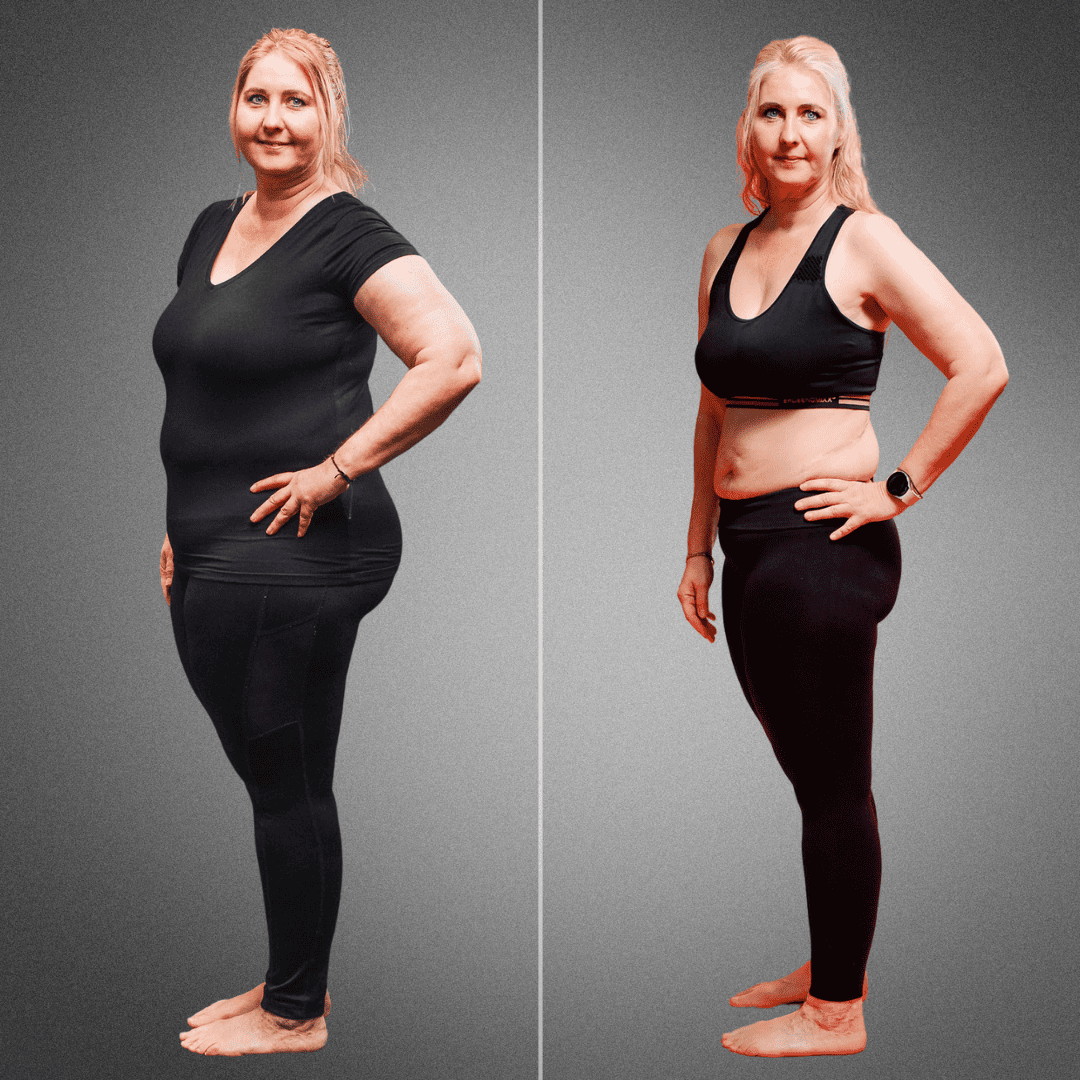 Vorher-nachher-Bild von Ines, die trotz Lipödem mit der richtigen Ernährung 28,1 kg abgenommen hat.