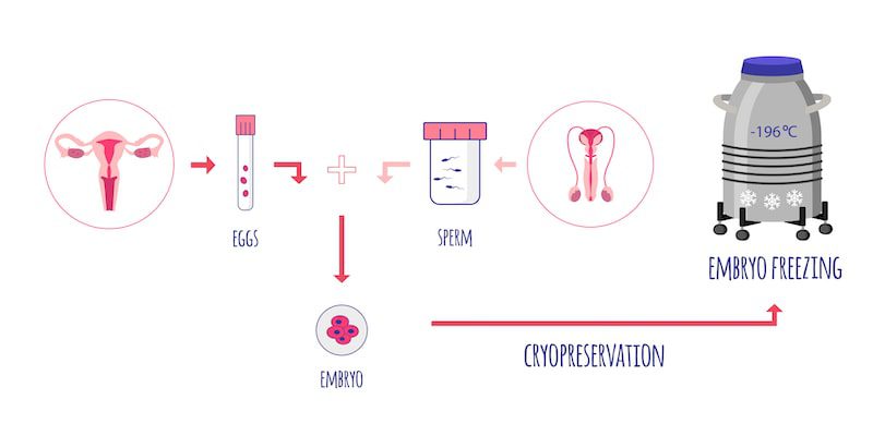 An illustration of the embryo freezing or cryopreservation process.