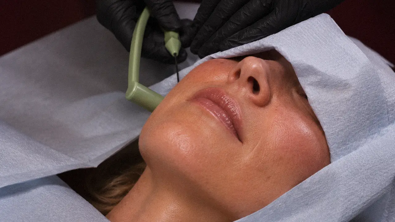 Image if a patient doing facial cosmetic surgery planning with Dr. Paul Denton from Refine Cosmetic Surgery in Vancouver, BC