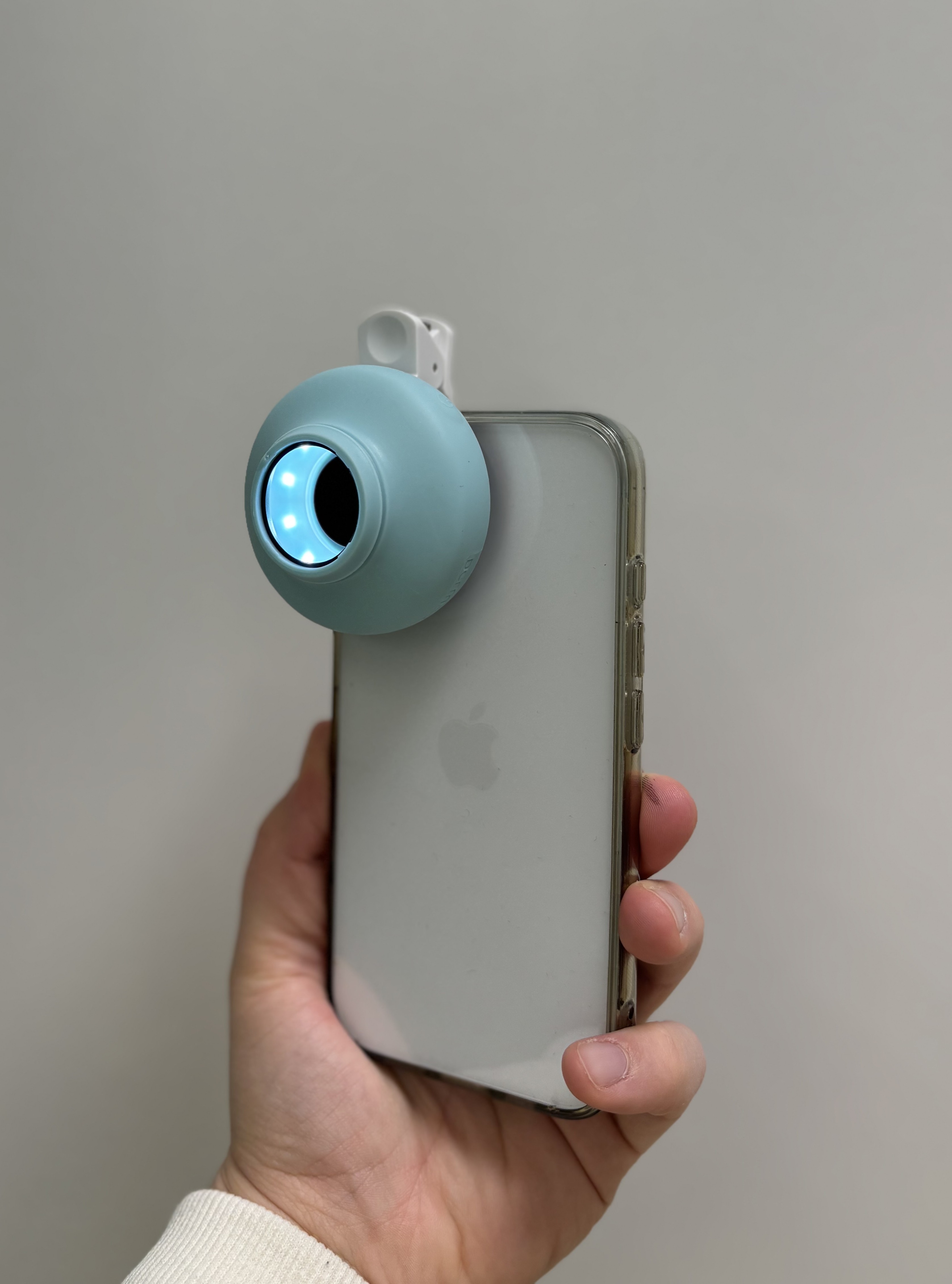 Smartphone mit aufgestecktem Dermatoskop