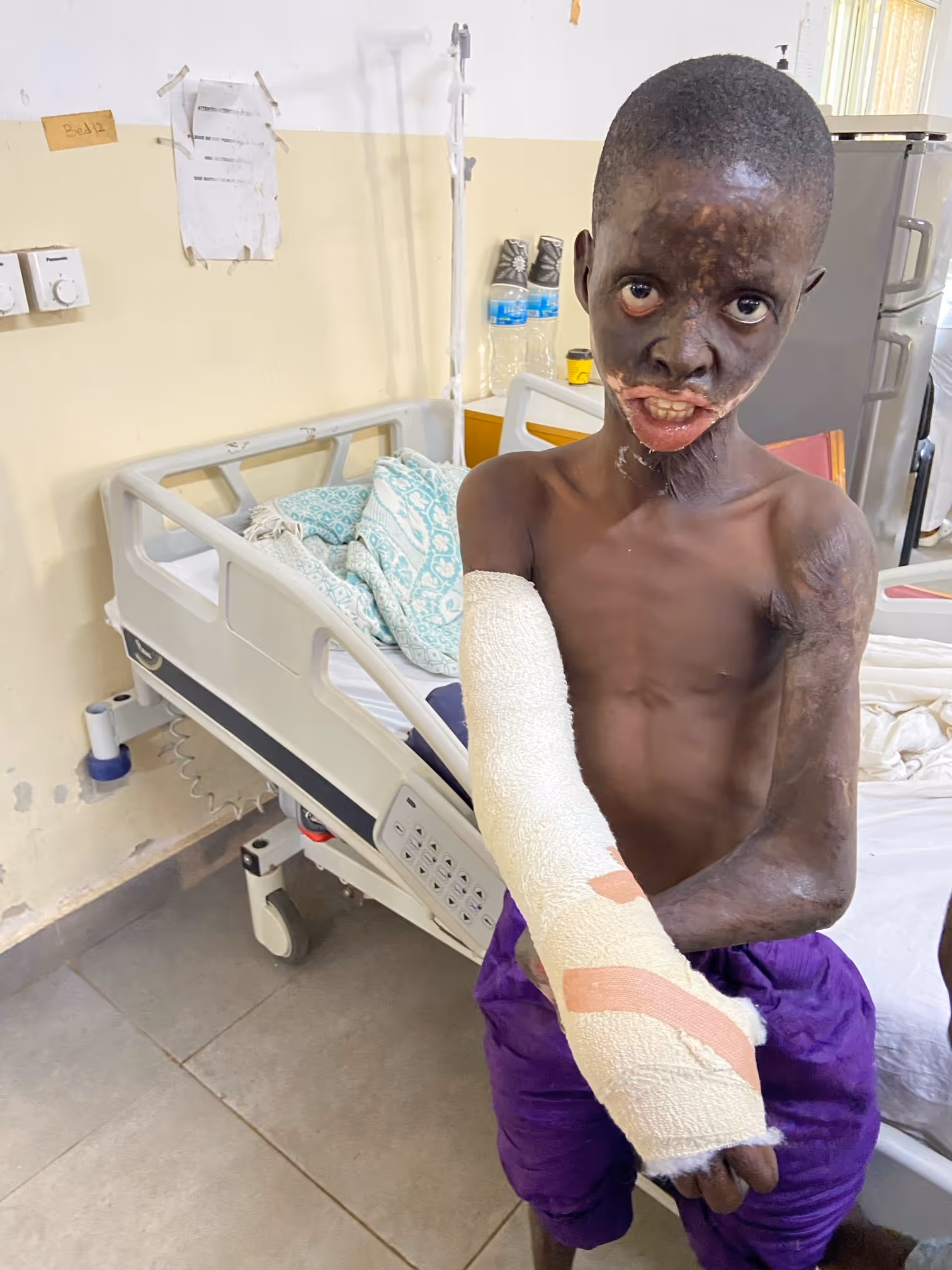 A young person with a bandaged arm stands next to a hospital bed.