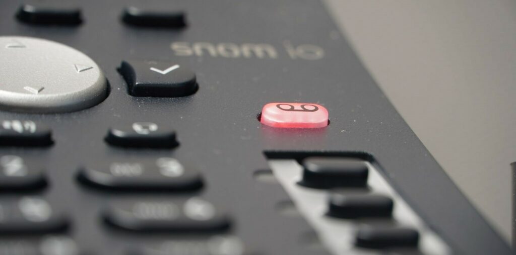 A photograph of remote control buttons