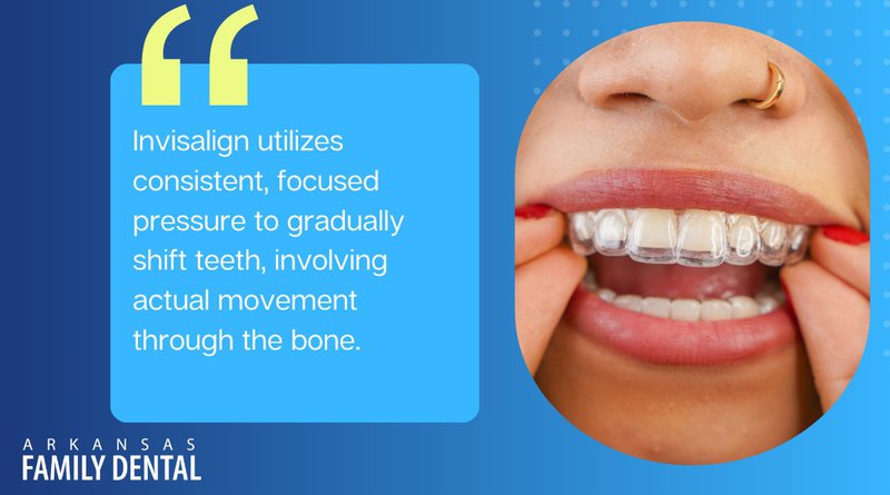 how invisalign works