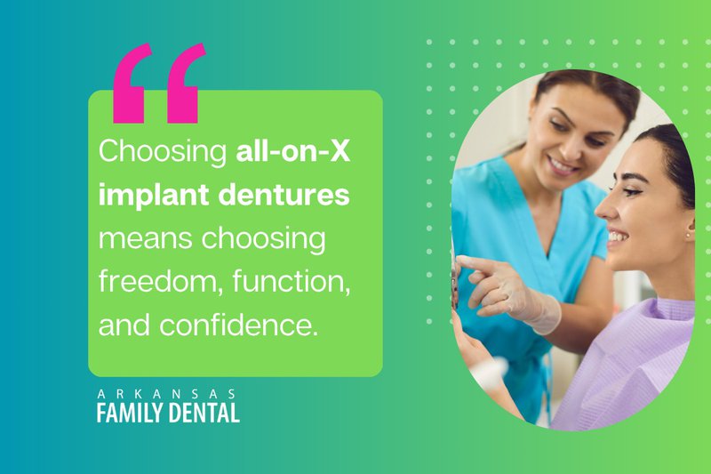 Choosing all-on-X implant dentures means choosing freedom, function, and confidence."