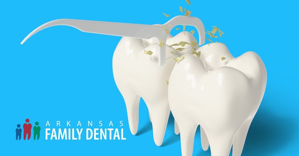 Discover the Powerful Benefits of Flossing cover