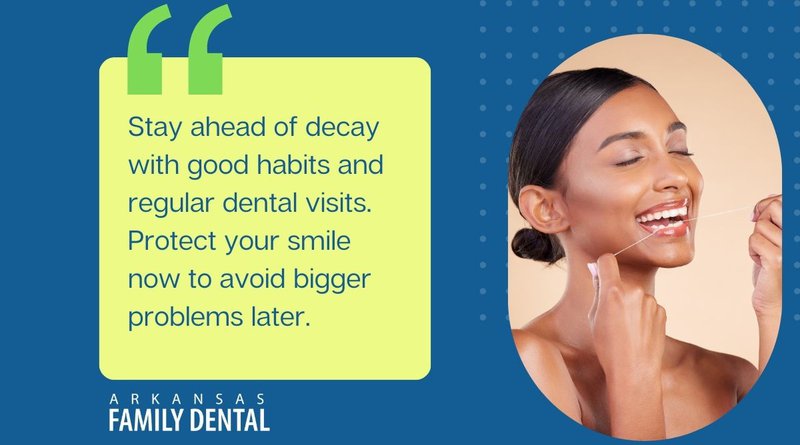 stages of tooth decay