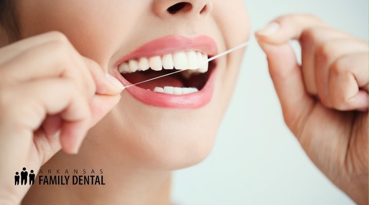 Stages of Tooth Decay: What Are the Five Phases? cover