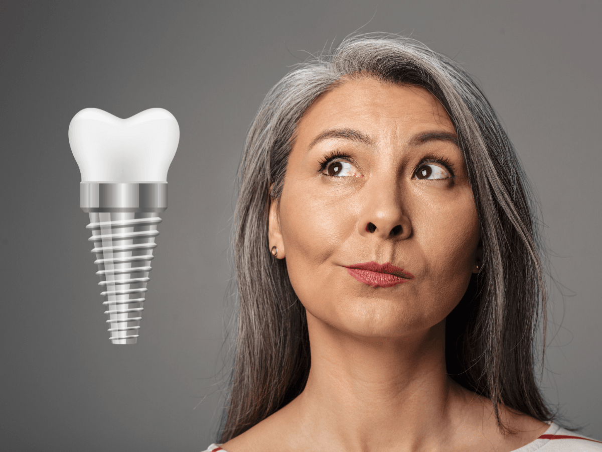 Dental Implants vs. Dental Bridges cover