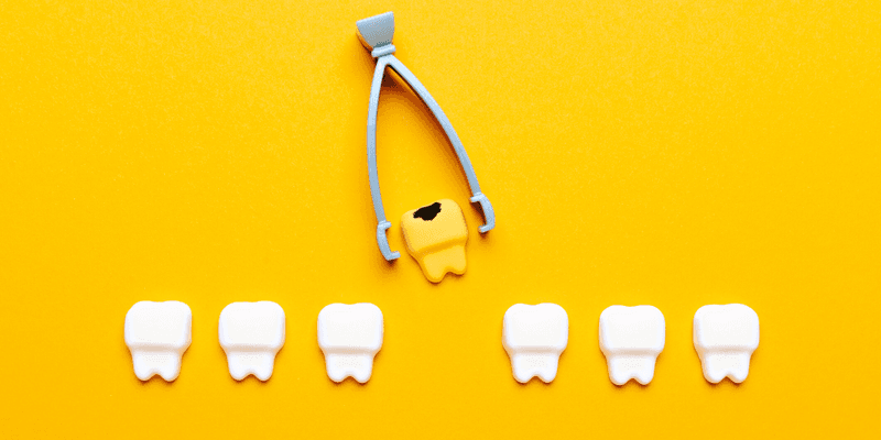 when does a tooth need to be pulled?