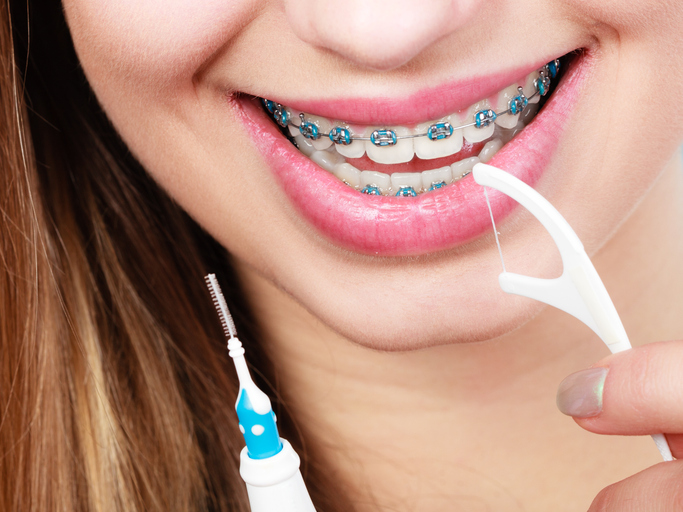 Tips to make it easier flossing with braces.