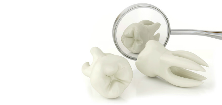 Signs That Tooth Needs to be Pulled