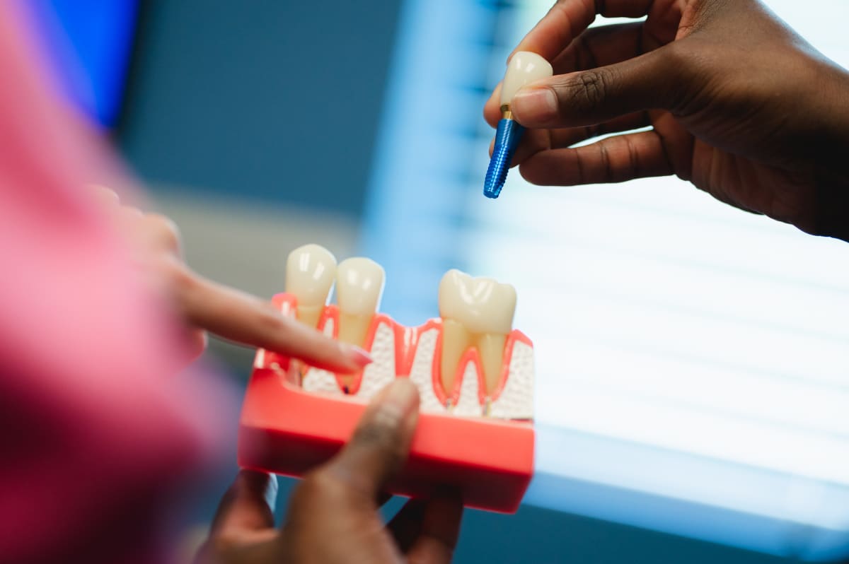 Dental implant model showing tooth structure being demonstrated during patient consultation